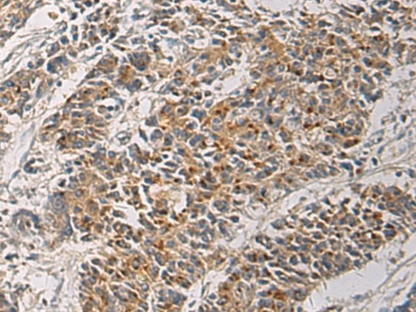 MAPKAPK3 Polyclonal Antibody - image 1