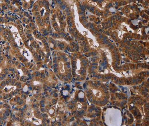 RTN4R Polyclonal Antibody - image 1