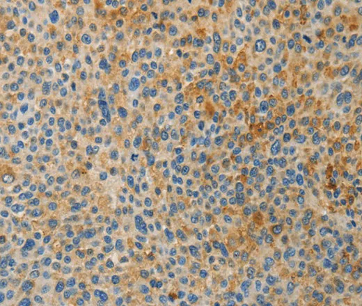 BAAT Polyclonal Antibody - image 1