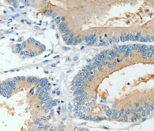 BAAT Polyclonal Antibody - image 2