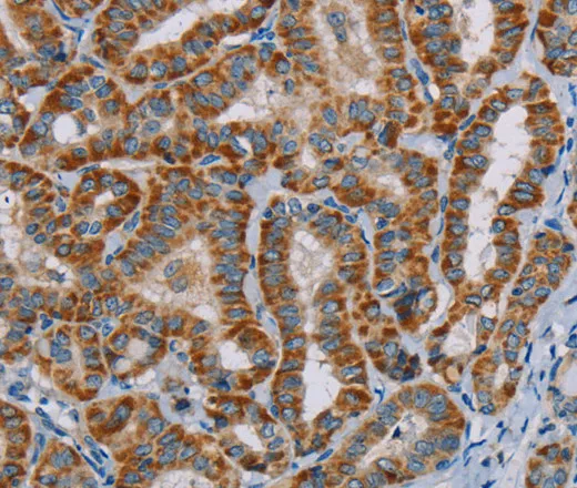 MTCH2 Polyclonal Antibody - image 1