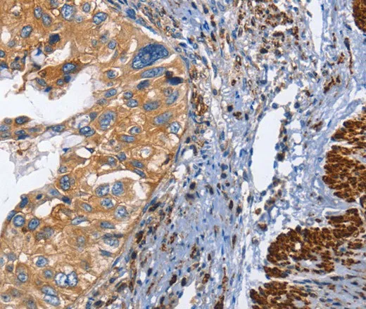CD45 Polyclonal Antibody - image 1