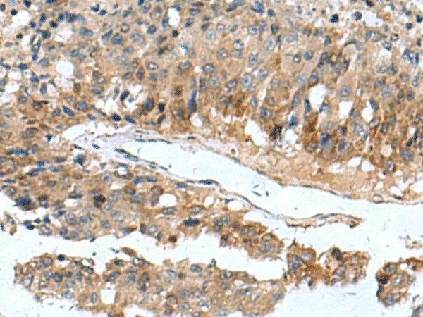 PDCD5 Polyclonal Antibody - image 1