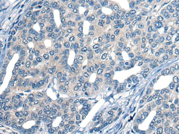 MARK2 Polyclonal Antibody - image 1