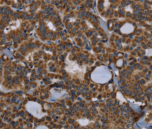 NPHS2 Polyclonal Antibody - image 1