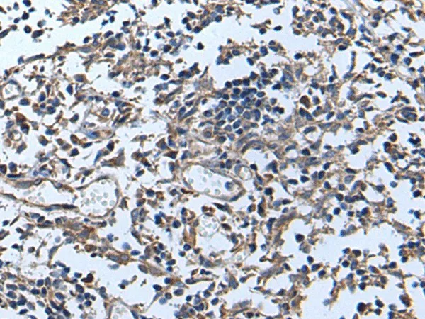 APOD Polyclonal Antibody - image 2