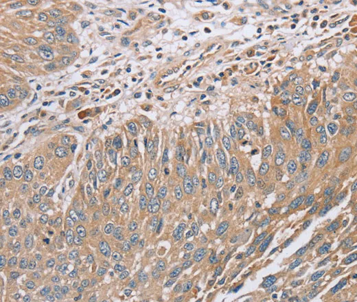 RAB8B Polyclonal Antibody - image 1