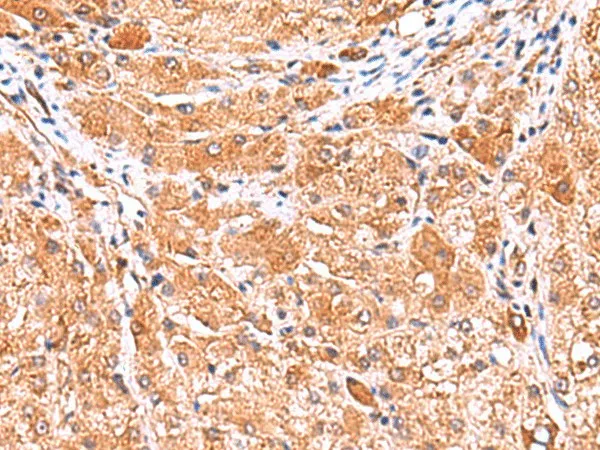 PHKG2 Polyclonal Antibody - image 1