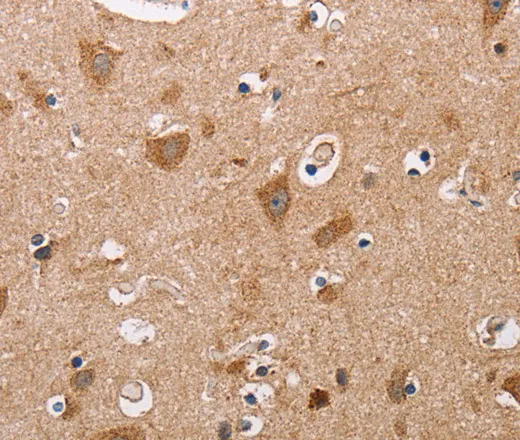 ALG9 Polyclonal Antibody - image 1