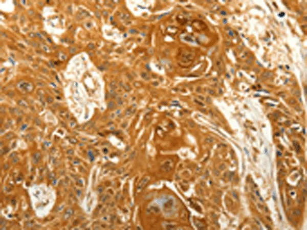 VSNL1 Polyclonal Antibody - image 1