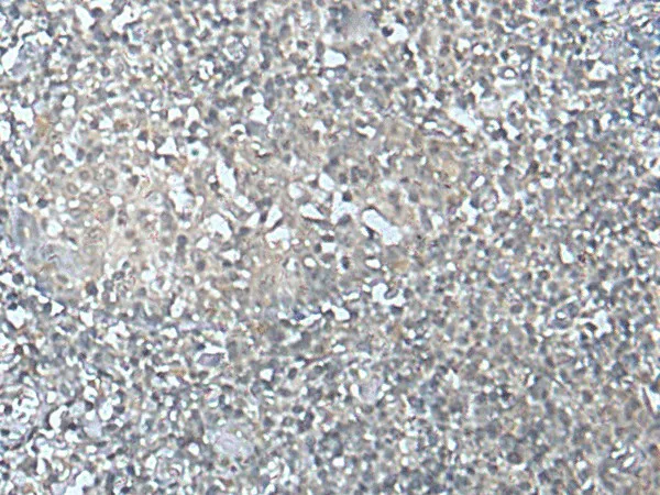 MEF2D Polyclonal Antibody - image 1