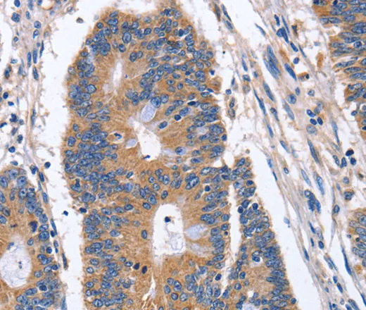 BMP6 Polyclonal Antibody - image 1