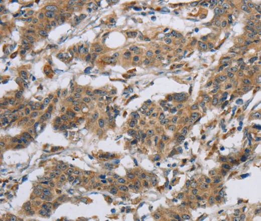 SYN2 Polyclonal Antibody - image 1