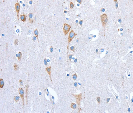 CD133 Polyclonal Antibody - image 1