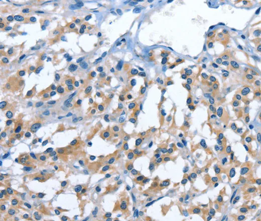 PAK6 Polyclonal Antibody - image 1