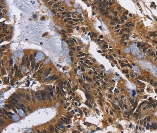 EPHB6 Polyclonal Antibody - image 1