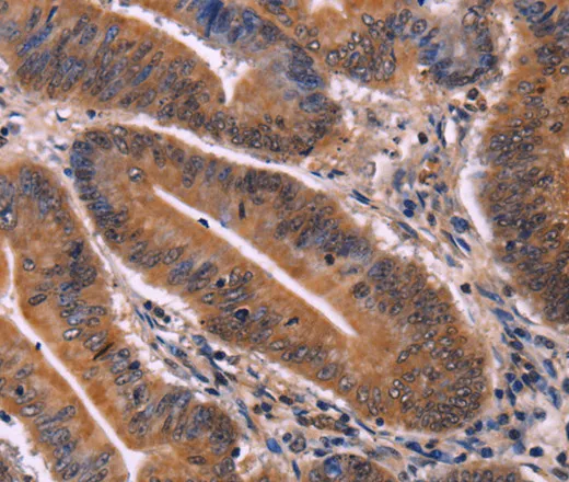 CDC5L Polyclonal Antibody - image 1