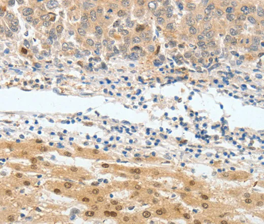 BPIFB2 Polyclonal Antibody - image 1