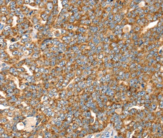 SLC8A3 Polyclonal Antibody - image 1