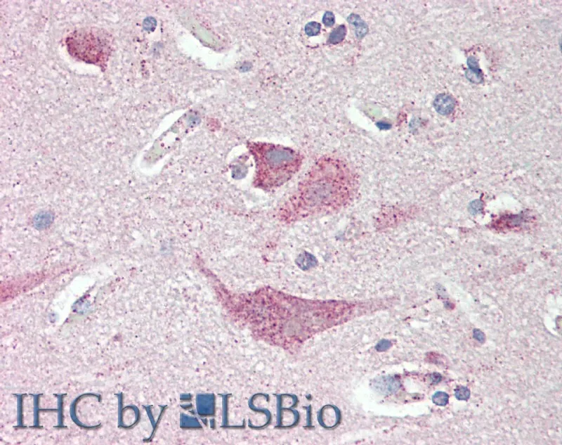 SLC8A3 Polyclonal Antibody - image 2