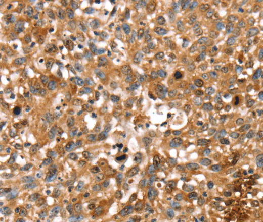 STAR Polyclonal Antibody - image 1
