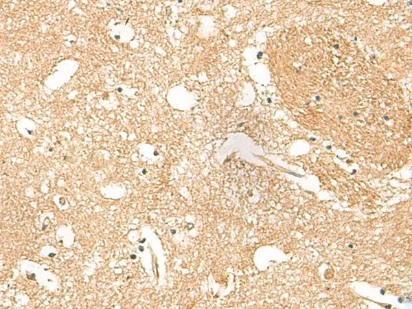HPCA Polyclonal Antibody - image 1