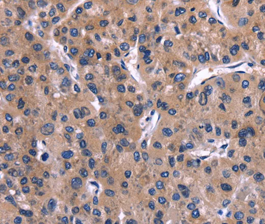 IL1A Polyclonal Antibody - image 1