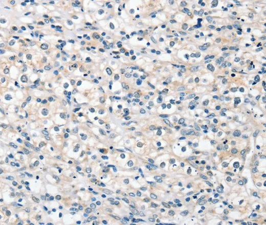 ROR1 Polyclonal Antibody - image 1