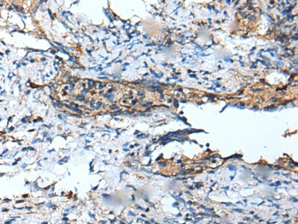 DEFB104A Polyclonal Antibody - image 1