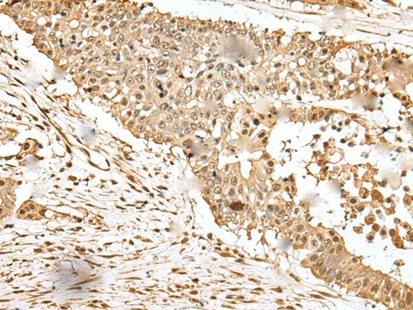 EEF1E1 Polyclonal Antibody - image 2