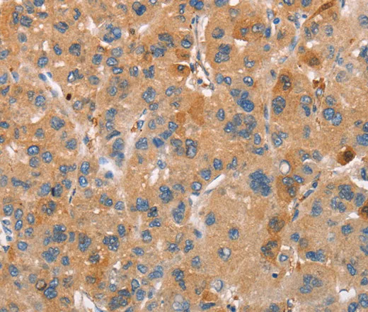 PLIN2 Polyclonal Antibody - image 1