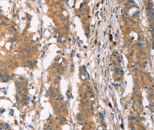 PLIN2 Polyclonal Antibody - image 2