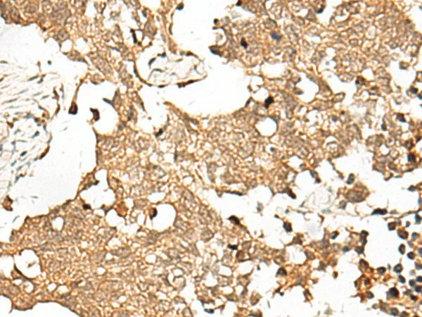 SNAPC5 Polyclonal Antibody - image 1