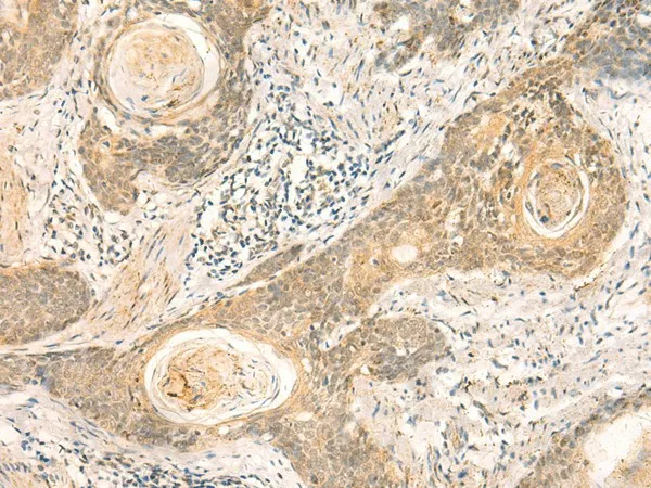 NIP7 Polyclonal Antibody - image 1