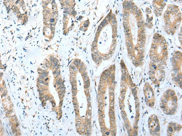 ACBD4 Polyclonal Antibody - image 1