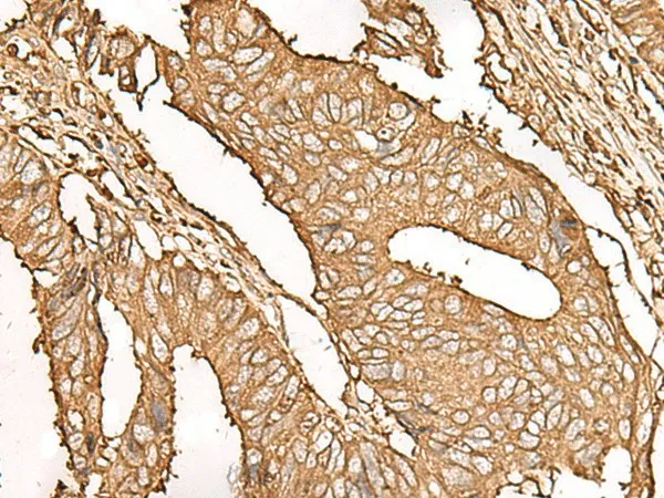UBE2A Polyclonal Antibody - image 1