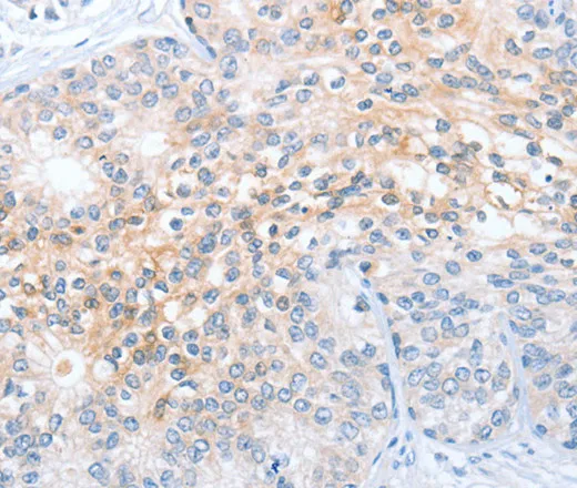 OX2R Polyclonal Antibody - image 1