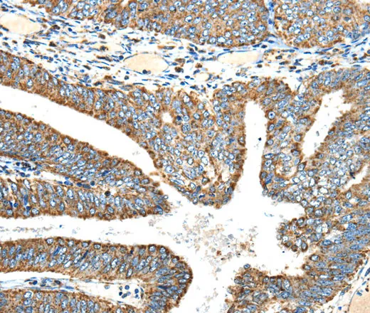 NDUFA5 Polyclonal Antibody - image 1