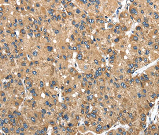 NDUFA5 Polyclonal Antibody - image 2
