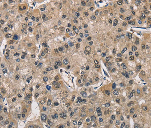 PGK1 Polyclonal Antibody - image 1
