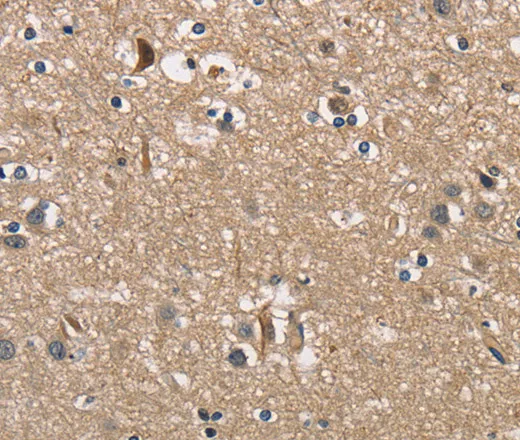 PGK1 Polyclonal Antibody - image 2