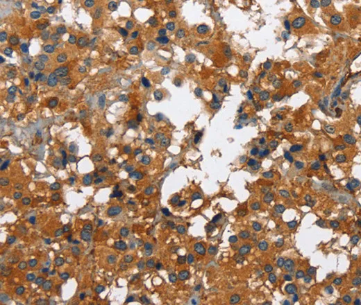 CATSPER3 Polyclonal Antibody - image 1