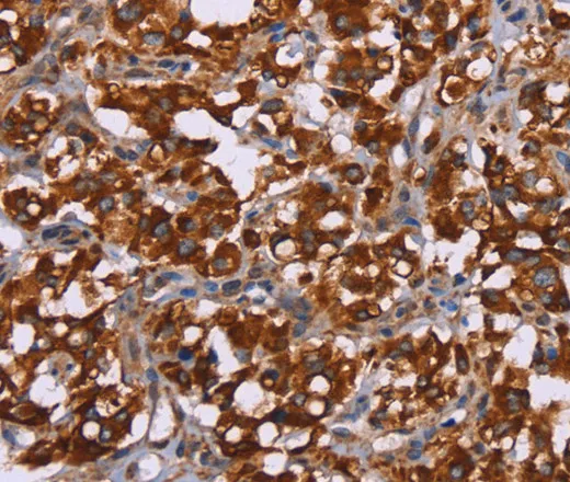 CYP2W1 Polyclonal Antibody - image 1