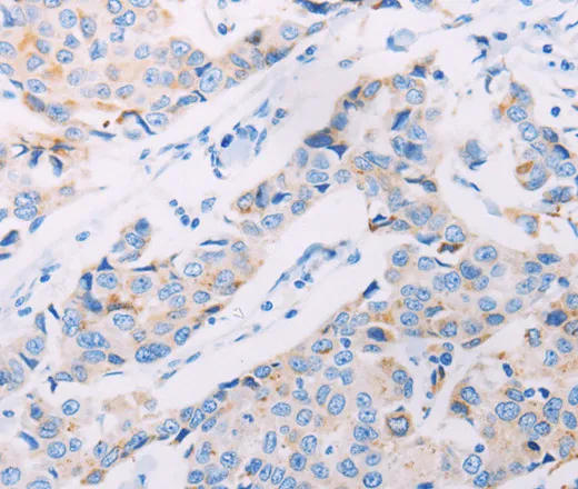 AKT2 Polyclonal Antibody - image 1