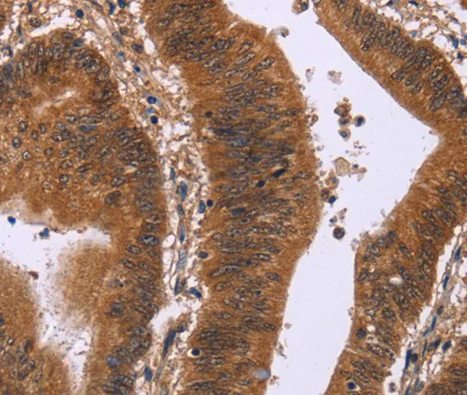 DCBLD2 Polyclonal Antibody - image 1