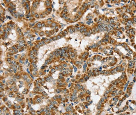 PPOX Polyclonal Antibody - image 1