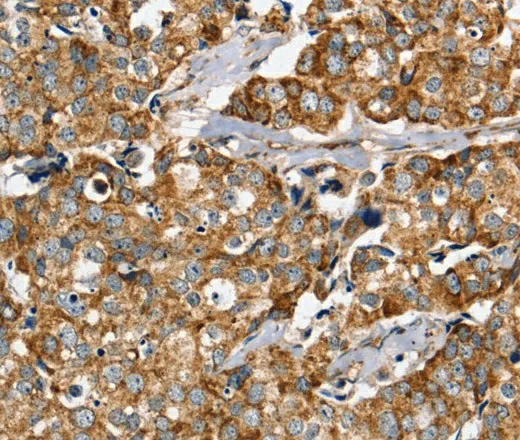 PPOX Polyclonal Antibody - image 2