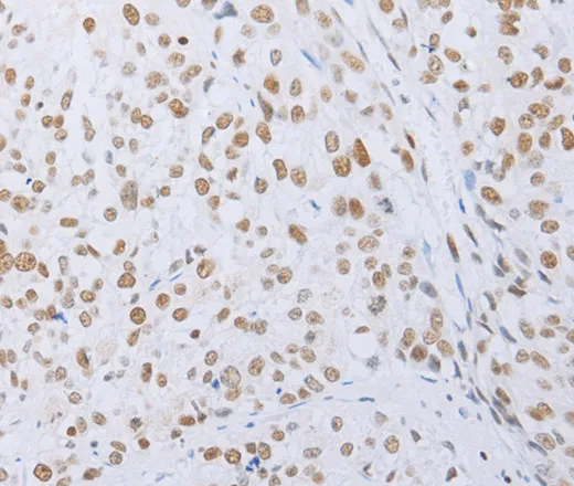 MCM2 Polyclonal Antibody - image 1
