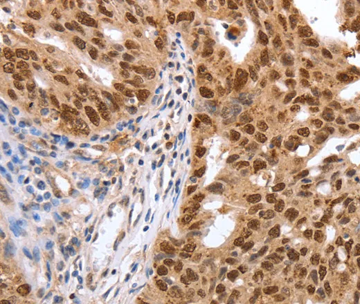 PARP1 Polyclonal Antibody - image 1