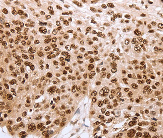 PARP1 Polyclonal Antibody - image 2